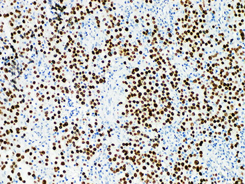 SALL4 Monoclonal Antibody Stored at 2~8°C