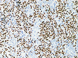 SALL4 Monoclonal Antibody Stored at 2~8°C