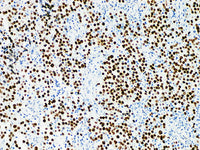SALL4 Monoclonal Antibody Stored at -20°C