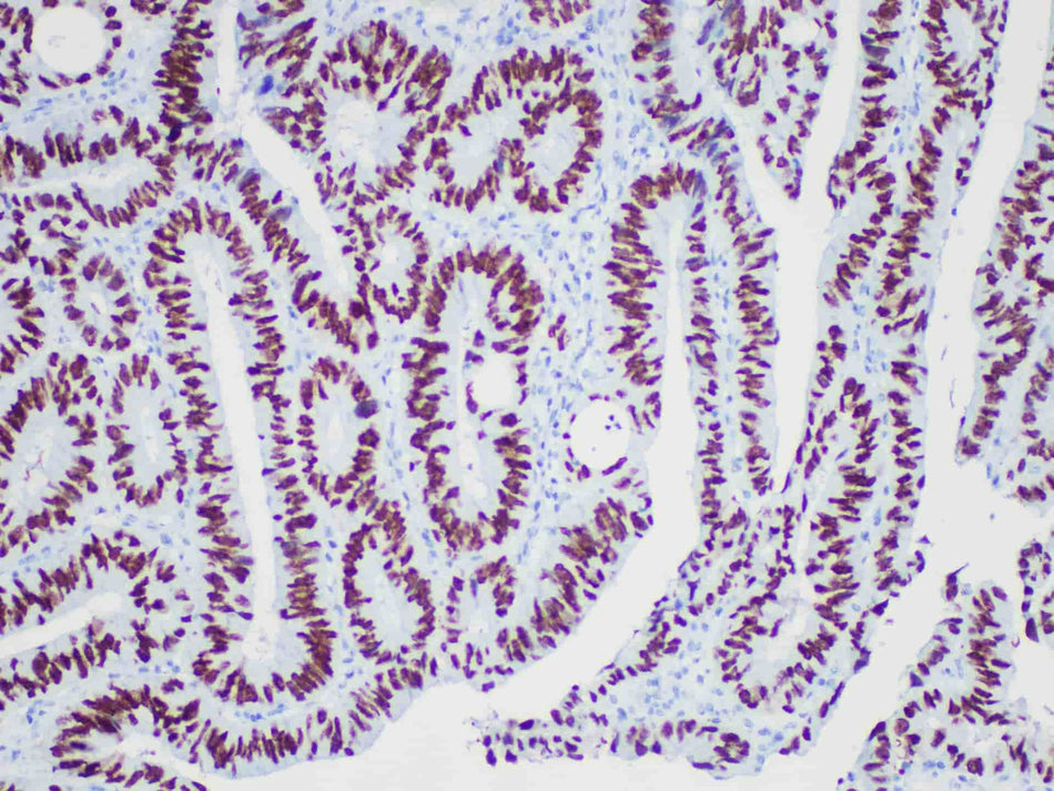 SATB2 Monoclonal Antibody Stored at 2~8°C