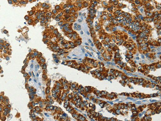 SERPINA9 Polyclonal Antibody Store at -20°C