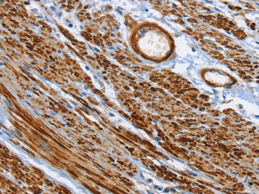 SHROOM2 Polyclonal Antibody