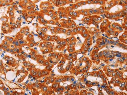 SLC25A4 Polyclonal Antibody Store at -20°C