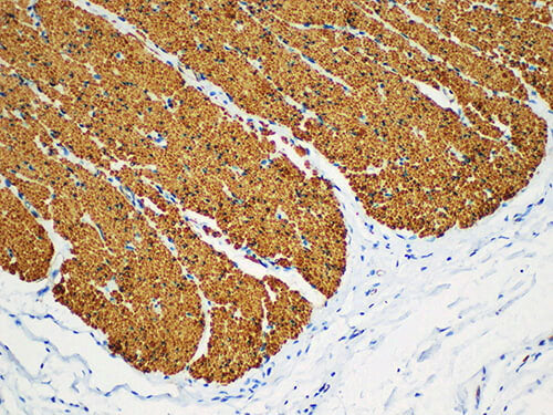 SMA Monoclonal Antibody Stored at 2~8°C