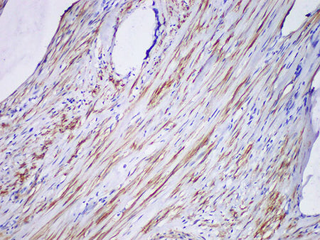 SMMHC Monoclonal Antibody Stored at 2~8°C