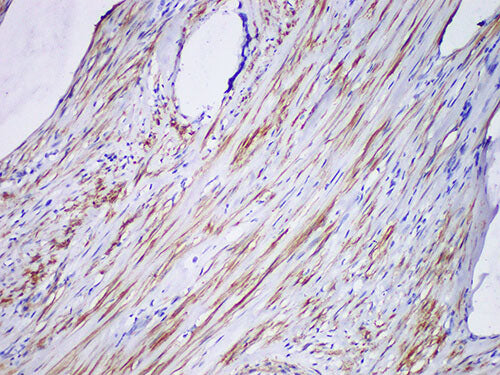 SMMHC Monoclonal Antibody Stored at 2~8°C