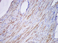 SMMHC Monoclonal Antibody Stored at -20°C