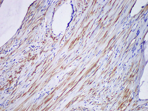 SMMHC Monoclonal Antibody Stored at -20°C