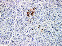 Somatostatin Monoclonal Antibody Stored at -20°C