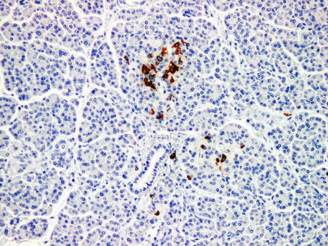 Somatostatin Monoclonal Antibody Stored at -20°C