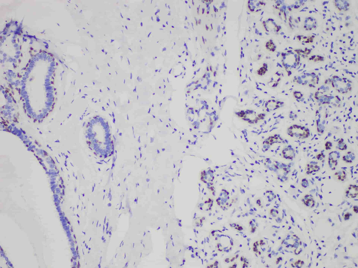 SOX10 Monoclonal Antibody Stored at 2~8°C