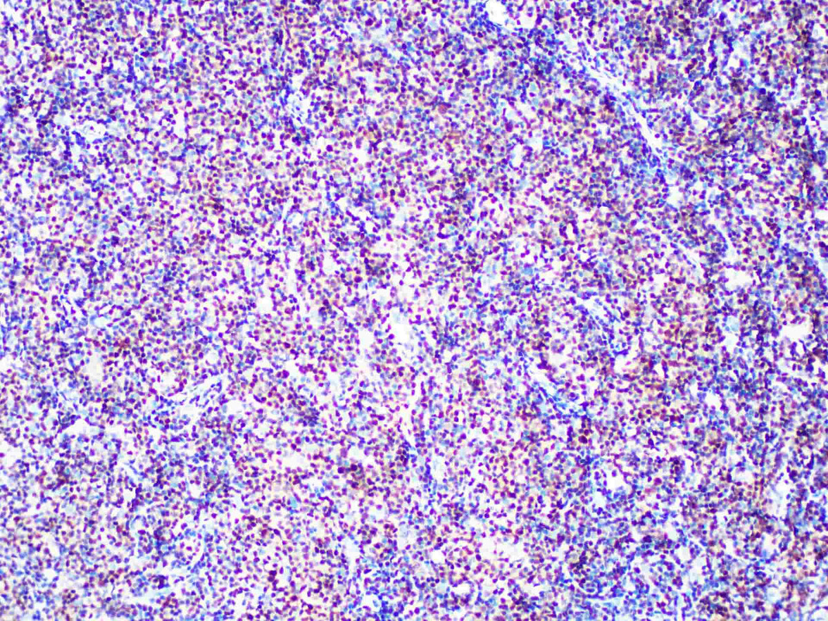 SOX11 Monoclonal Antibody