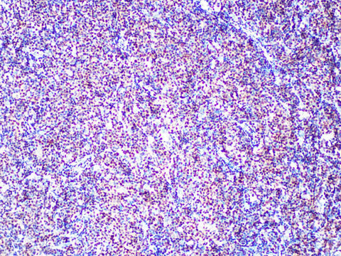 SOX11 Monoclonal Antibody