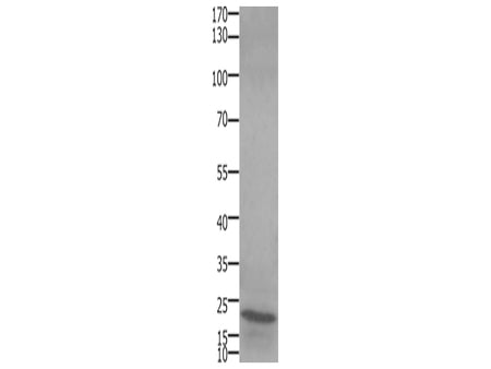 STMN2/3/4 Polyclonal Antibody Store at -20°C, Biomarkers, Elabscience Biotechnology, MSE Supplies