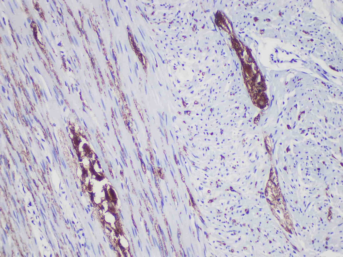 Synaptophysin (Syn) Monoclonal Antibody Stored at -20°C