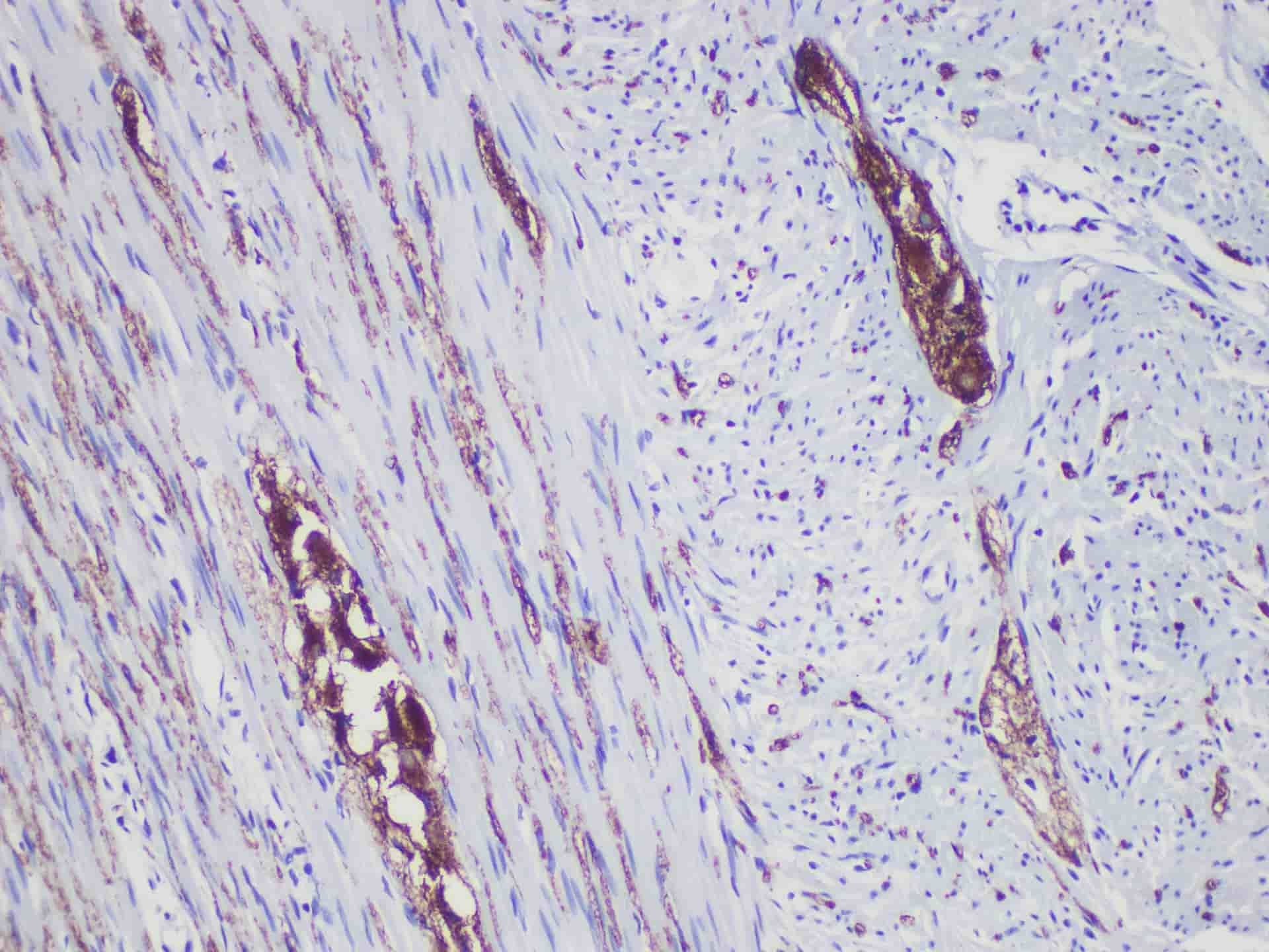 Synaptophysin (Syn) Monoclonal Antibody Stored at -20°C