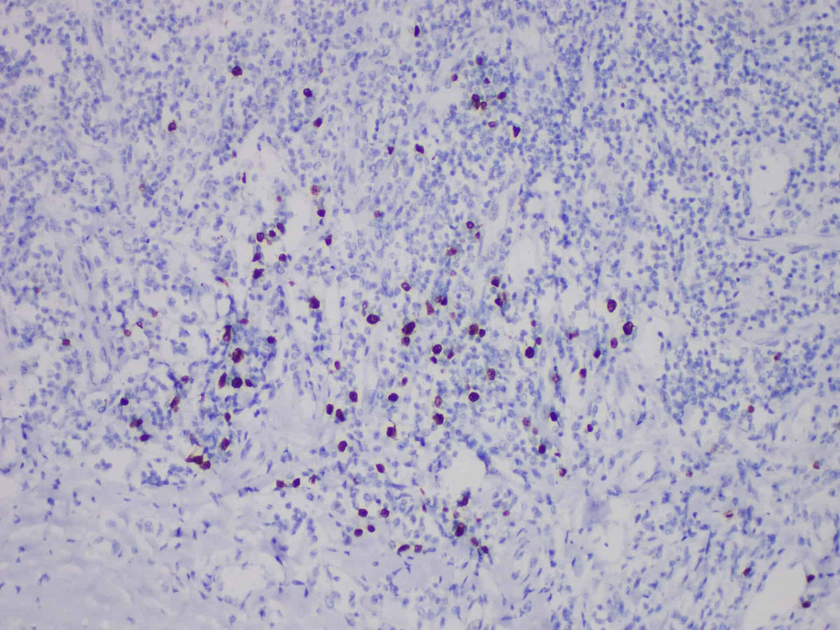 TdT Monoclonal Antibody Stored at 2~8°C