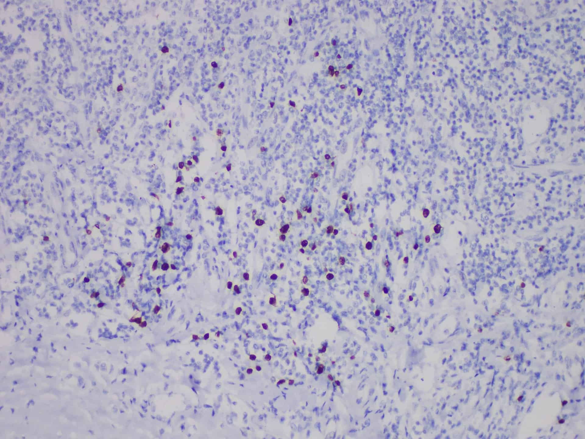 TdT Monoclonal Antibody Stored at 2~8°C
