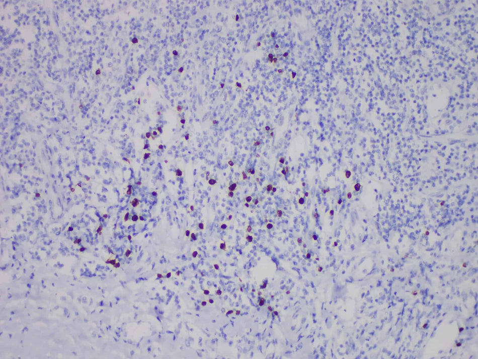 TdT Monoclonal Antibody Stored at 2~8°C