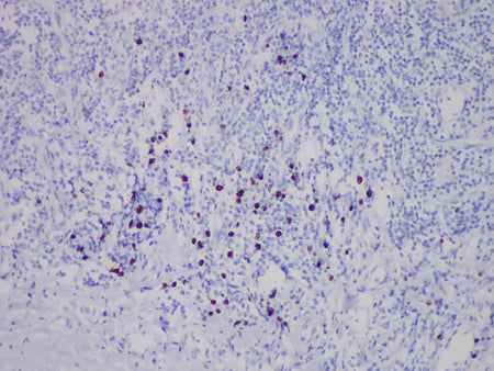 TdT Monoclonal Antibody Stored at -20°C
