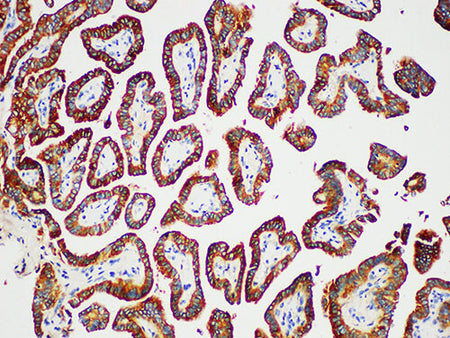 TG Monoclonal Antibody Stored at 2~8°C