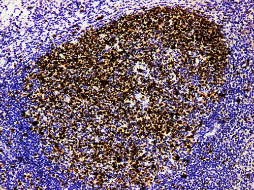 TOPO2A Monoclonal Antibody