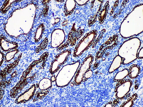 TPO Monoclonal Antibody Stored at 2~8°C