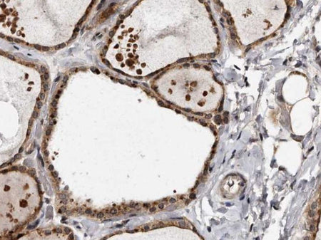 TSH Monoclonal Antibody Stored at -20°C