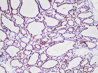 TTF-1 Monoclonal Antibody Stored at 2~8°C