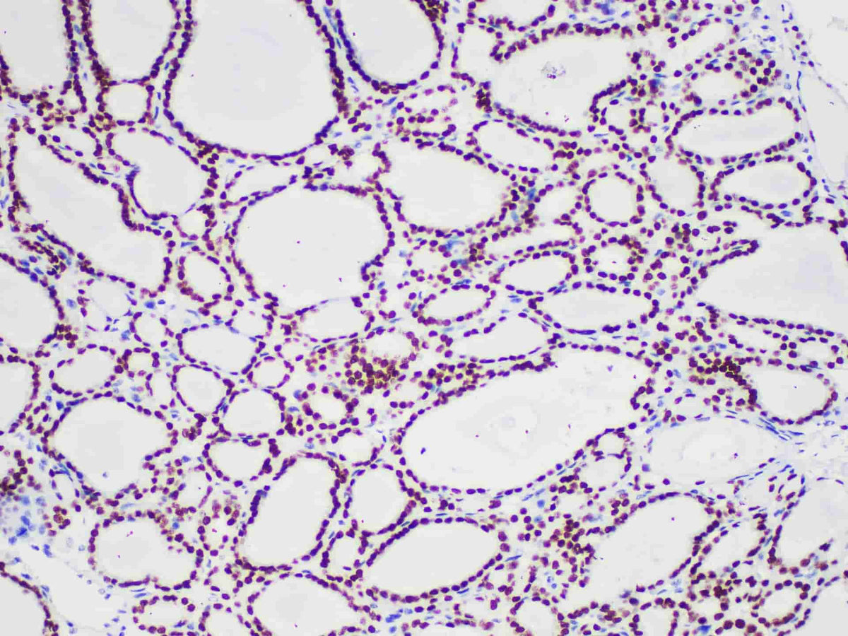 TTF1 Monoclonal Antibody Stored at -20°C
