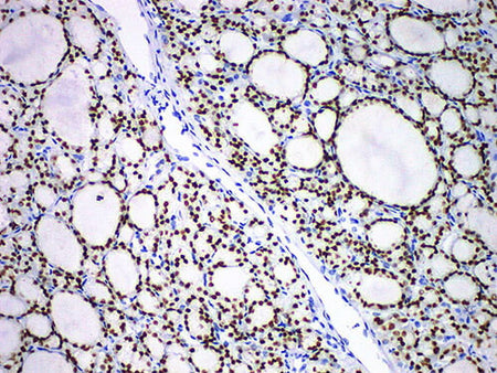 TTF1 Monoclonal Antibody Stored at -20°C
