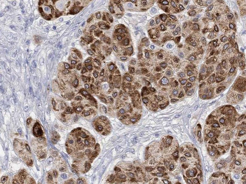 Tyrosinase Monoclonal Antibody Stored at -20°C