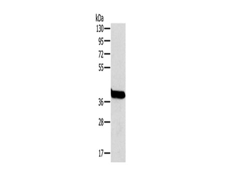 OTC Polyclonal Antibody Store at -20°C