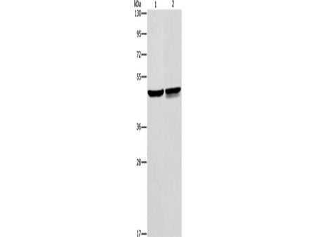 AMACR Polyclonal Antibody Store at -20°C