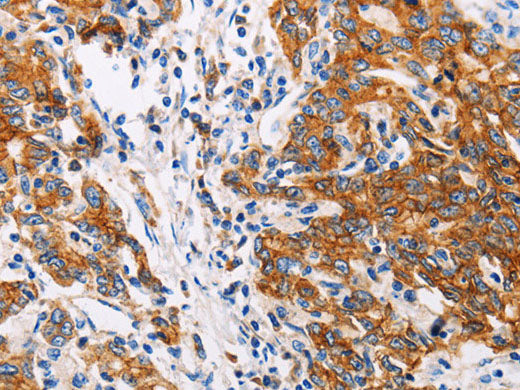 Cathepsin B Polyclonal Antibody Store at -20°C
