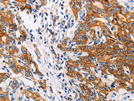 Cathepsin B Polyclonal Antibody Store at -20°C