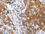 CTNNA1 Polyclonal Antibody