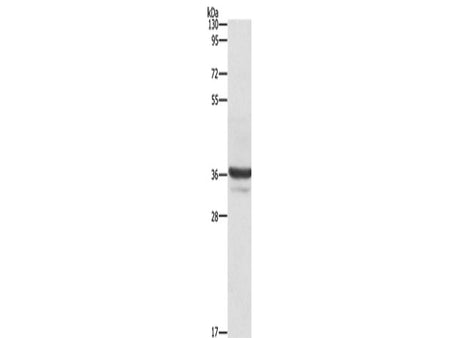 ANXA3 Polyclonal Antibody Store at -20°C