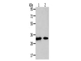 SLC25A4 Polyclonal Antibody Store at -20°C