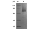 Recombinant Human IL7RA/CD127 Protein (Fc & His Tag)