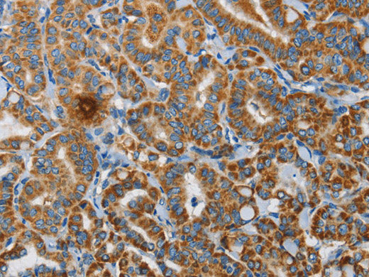 UPF1 Polyclonal Antibody Store at -20°C