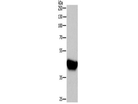 BABAM2 Polyclonal Antibody Store at -20°C