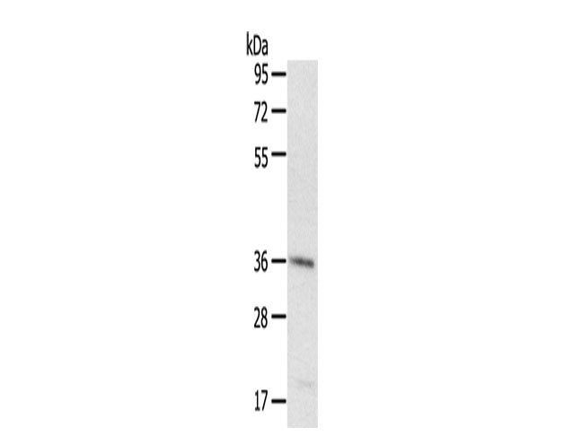 PDLIM4 Polyclonal Antibody Store at -20°C