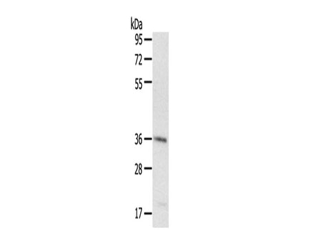 PDLIM4 Polyclonal Antibody Store at -20°C