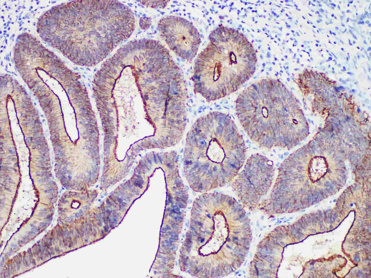 Villin Monoclonal Antibody Stored at 2~8°C