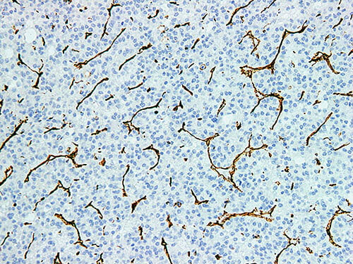 Vimentin Monoclonal Antibody Stored at 2~8°C