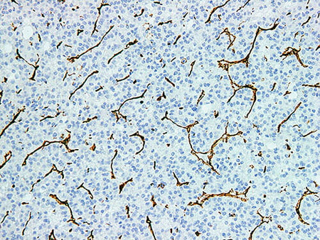 Vimentin Monoclonal Antibody Stored at 2~8°C