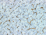 Vimentin Monoclonal Antibody Stored at 2~8°C