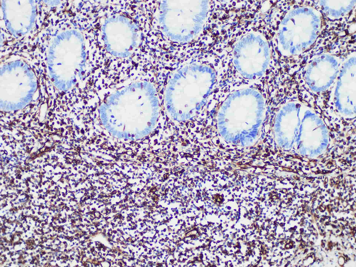 Vimentin Monoclonal Antibody Stored at -20°C Host Rabbit