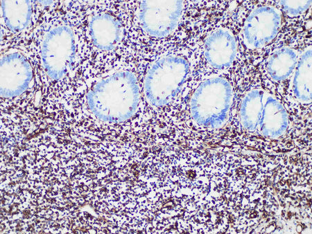 Vimentin Monoclonal Antibody Stored at -20°C Host Rabbit